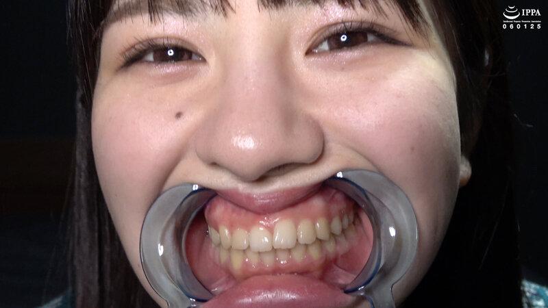 サムネイル 14