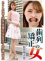 【ベストヒッツ】歯列矯正の女 長谷川古宵【アウトレット】